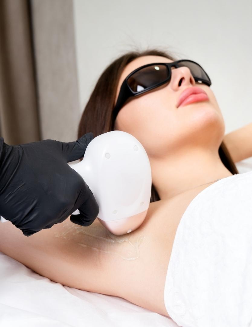 DEPILACIÓN LÁSER CABALLERO AXILA   INGLE DULCE CALVO para Unisex | Dulce Calvo