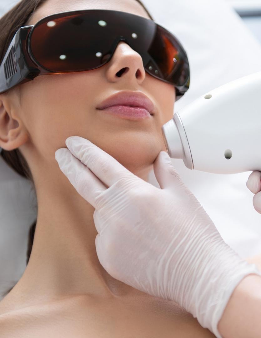 DEPILACIÓN LÁSER FACIAL COMPLETA DULCE CALVO para Unisex | Dulce Calvo