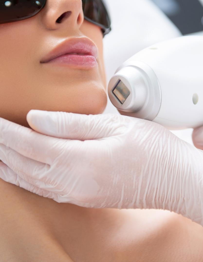 DEPILACIÓN LÁSER MENTÓN DULCE CALVO para Unisex | Dulce Calvo