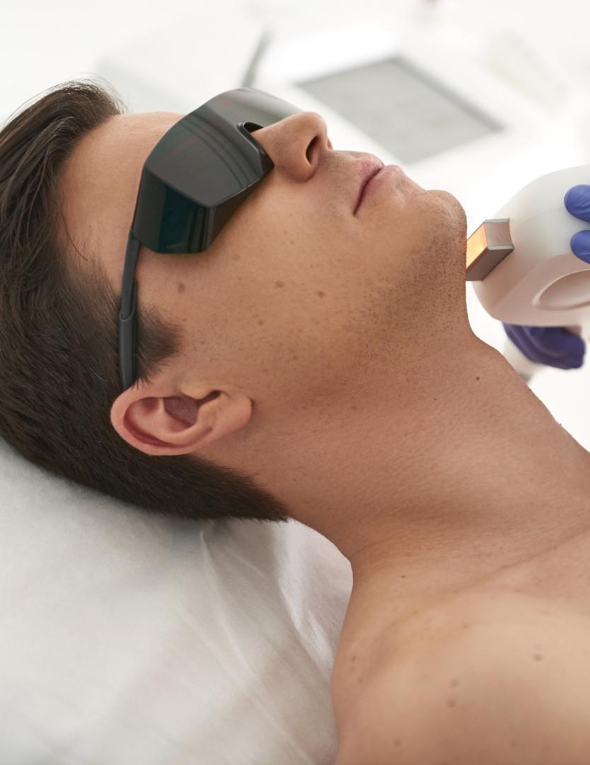 DEPILACIÓN LÁSER PATILLAS DULCE CALVO para Unisex | Dulce Calvo