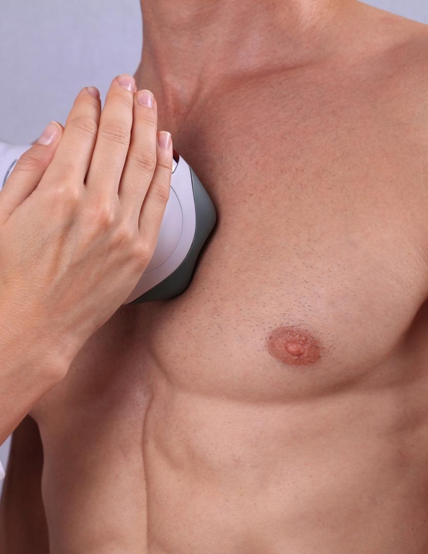 DEPILACIÓN LÁSER PECHO DULCE CALVO para Unisex | Dulce Calvo