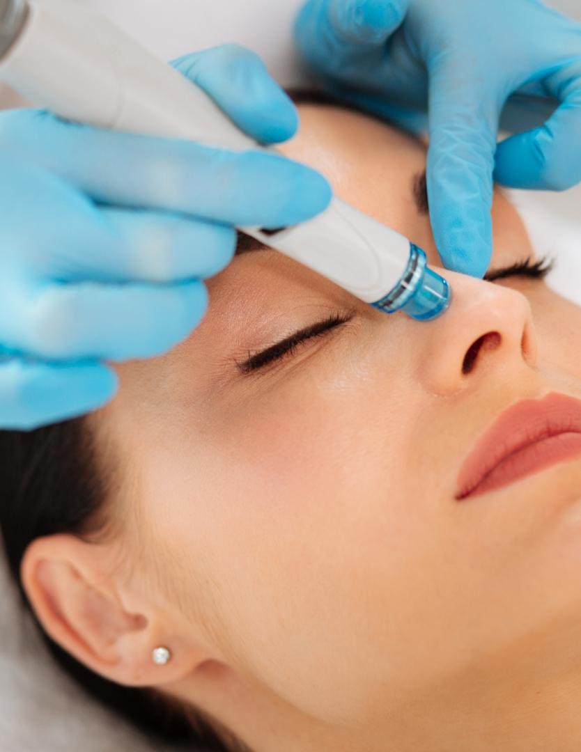 HYDRAFACIAL DELUXE DULCE CALVO para Unisex | Dulce Calvo